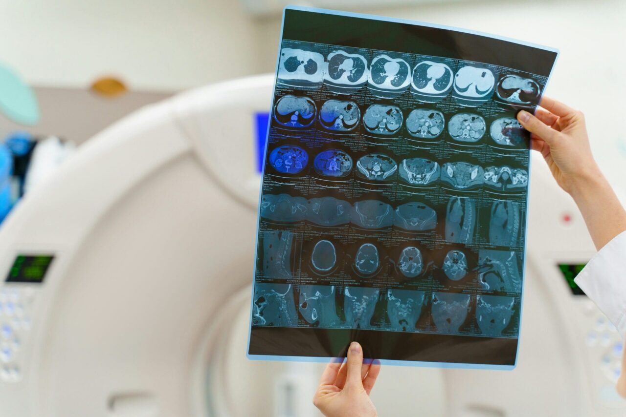 Juniper Biosciences Unveils JBS-002 and JBS-004, Advancing Two Late-Stage Diagnostic Programs to Registration Batch Manufacturing in the Fourth Quarter of 2026