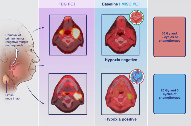 FMISO PET